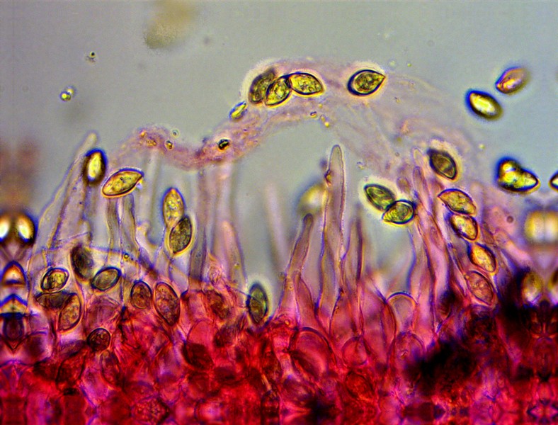 Mikroskopaufnahme des Körnigen Flockenschüpplings (Flammulaster granulosus), (c) Chris Engelhardt/naturgucker.de